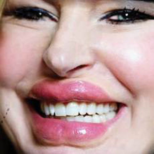 Lip Tuck 3D FX Transfers Lip Tuck 3D FX Transfers